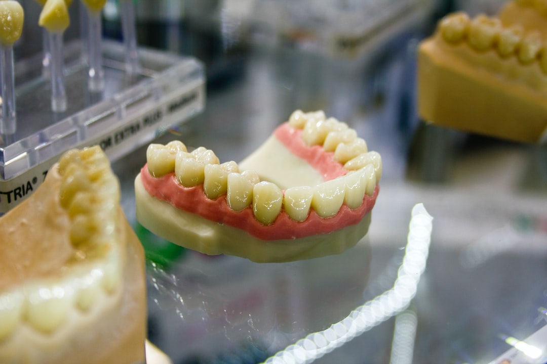 İnvisalign Tedavisinde Gerekli Röntgen ve İzlenimler