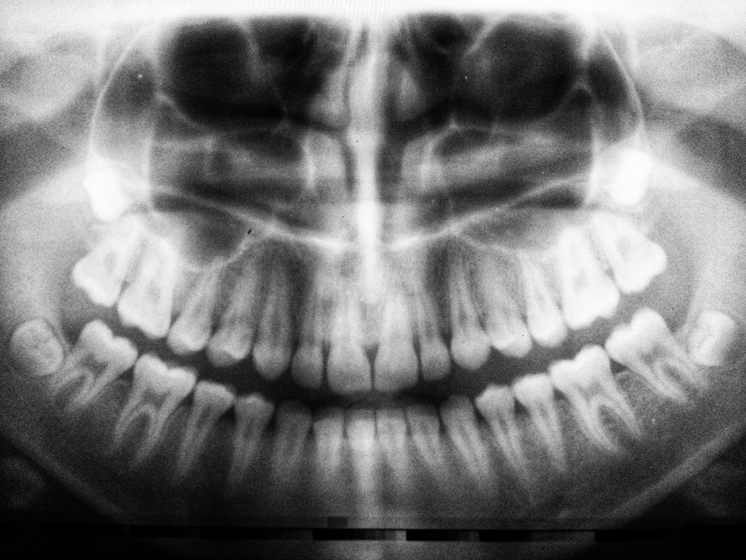 Invisalign vs. Şeffaf Tel Tedavisi: Ağız Hijyeni ve Temizlik Açısından Karşılaştırma 