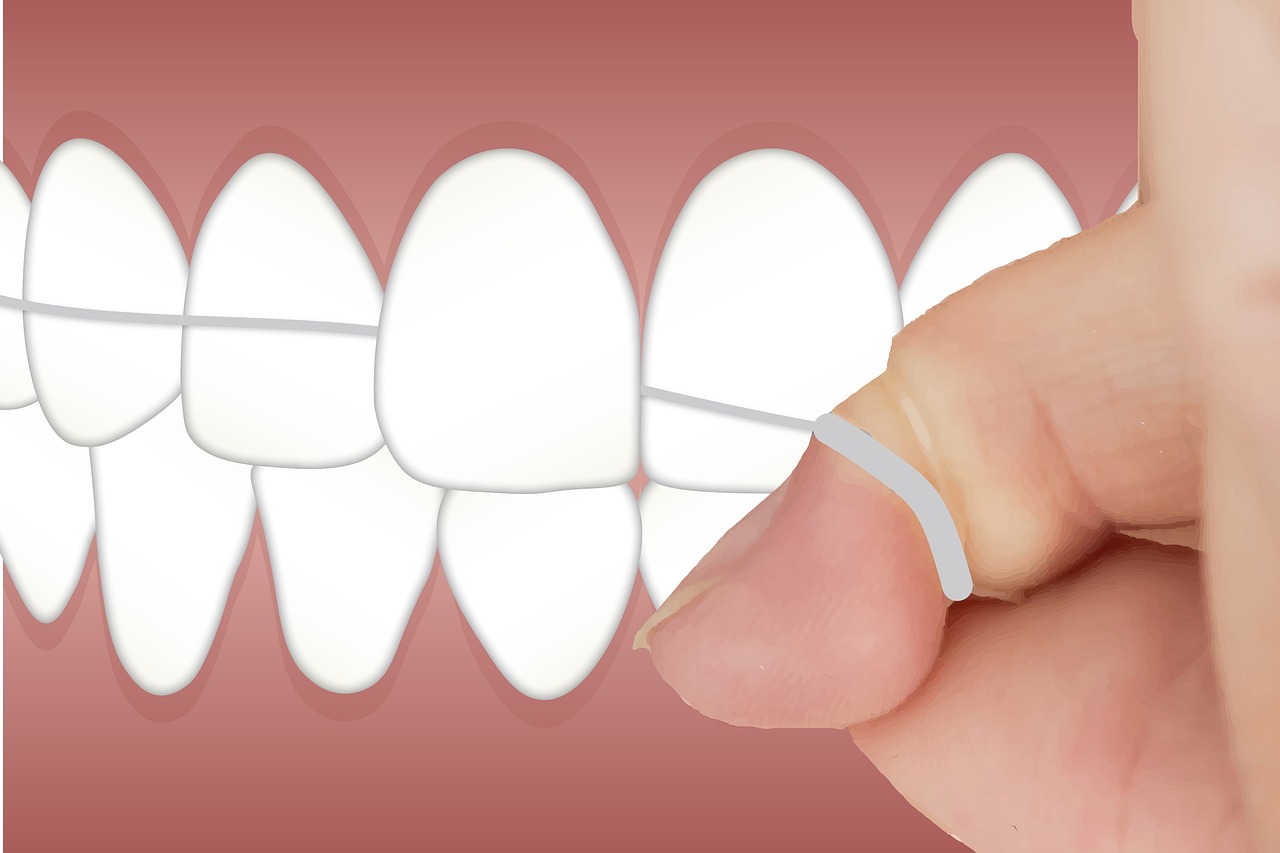 Diş İpi ve Dil Temizleyiciyle Invisalign Plaklarınızı Tamamen Temizleyin