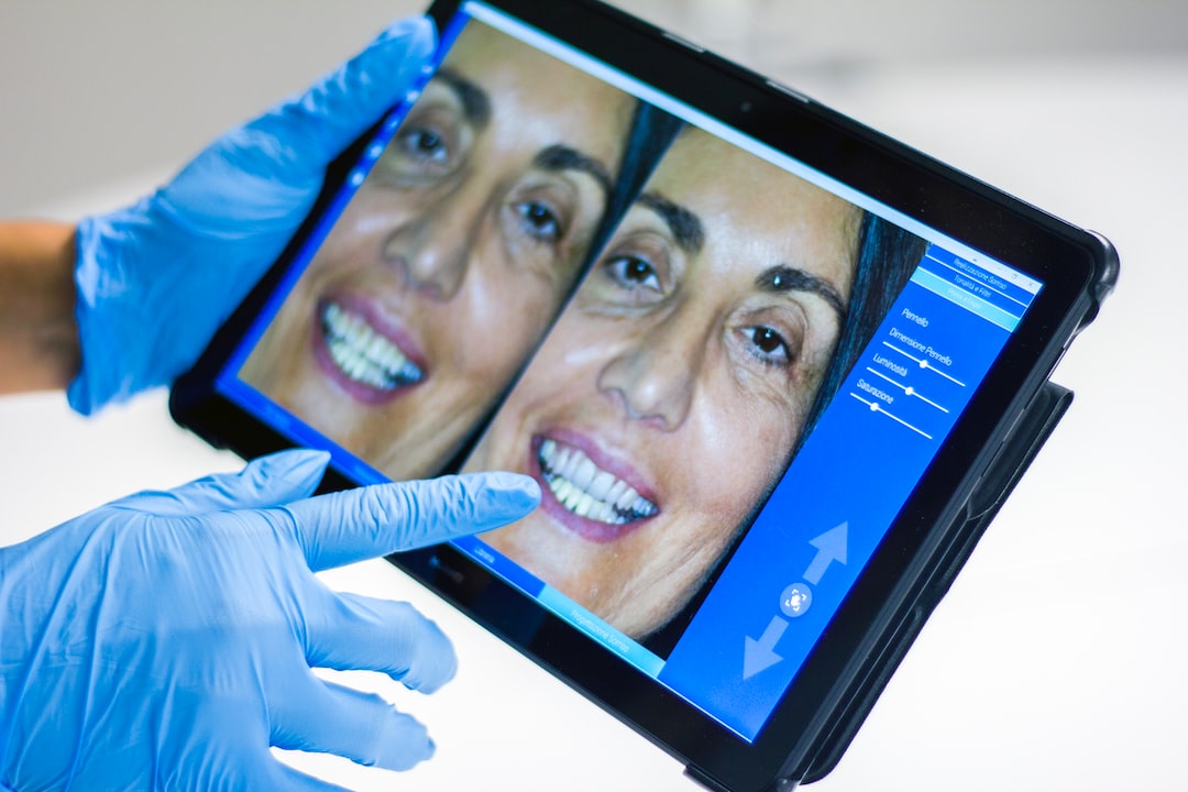 İnvisalign Tedavisinde Bilgisayar Simülasyonları