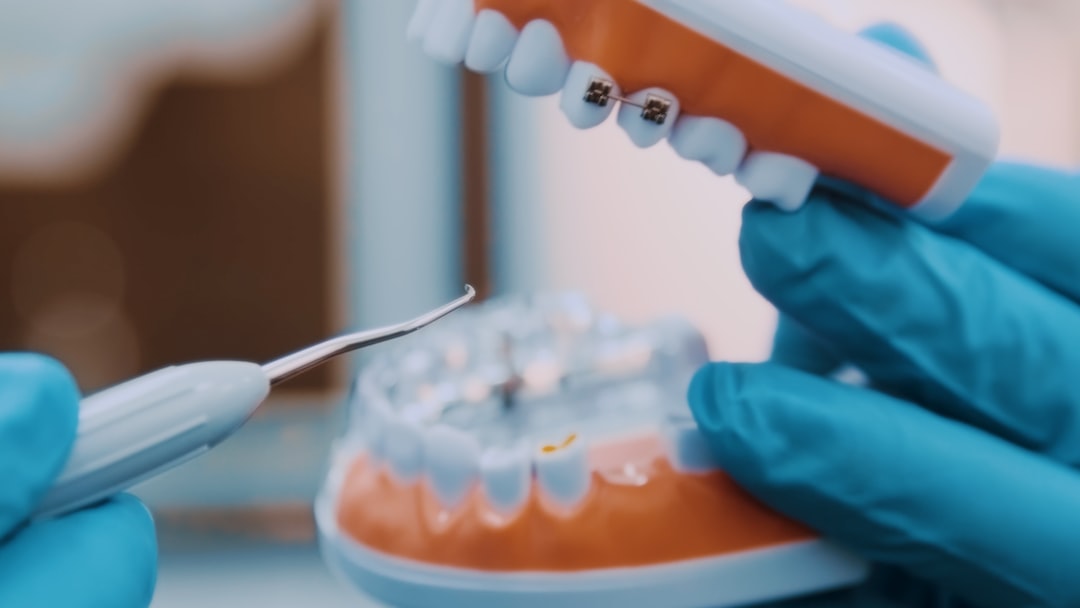 İnvisalign Tedavisinde Kontrol Randevuları