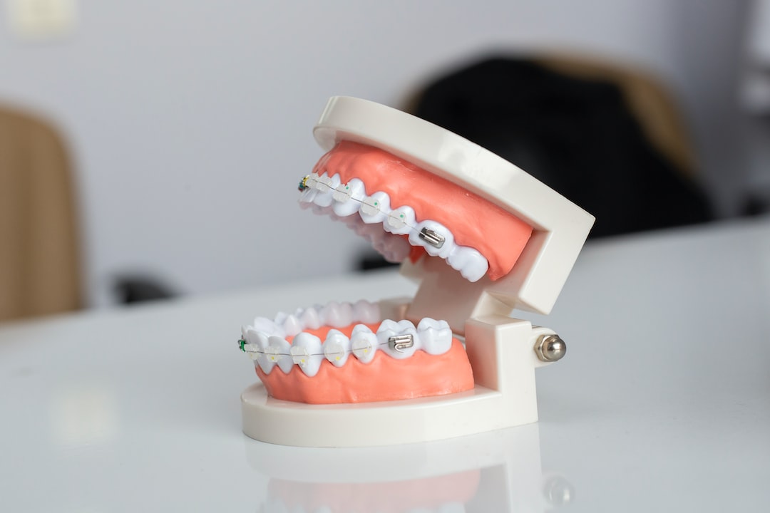 İnvisalign Tedavisi İçin İlk Muayene: Neler Beklemeli?