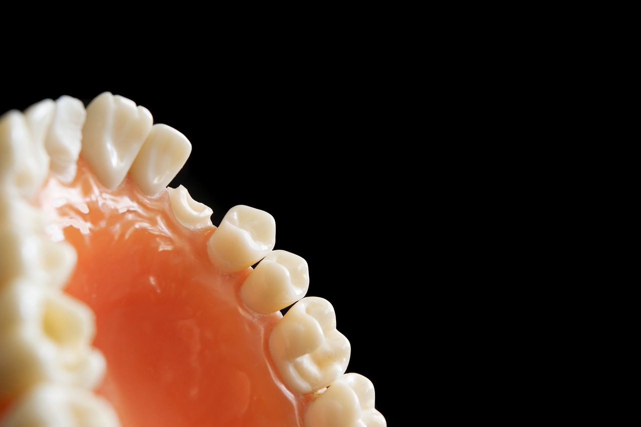 Invisalign İle Tedavi