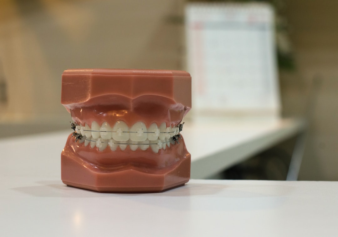 Invisalign Plaklarınızı Hijyenik Tutmanın Pratik Yolları