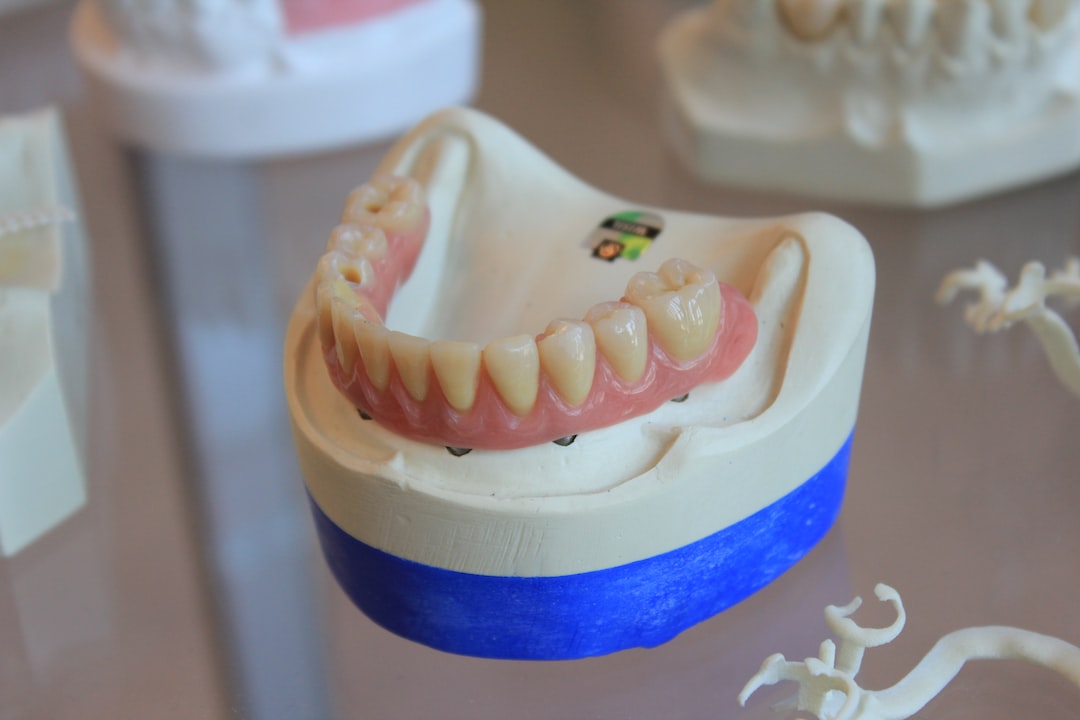 İnvisalign Tedavisi İçin İlk Plakları Alma ve Tedavi Sürecinin Heyecanı