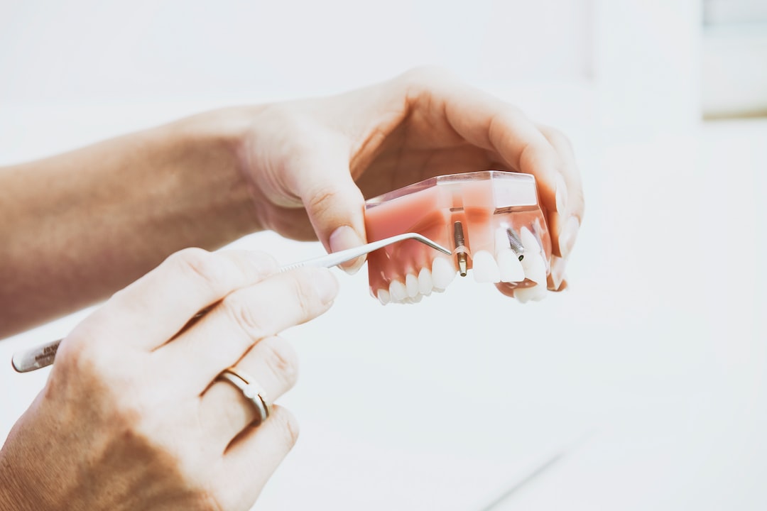 Invisalign Plaklarının Yemekle İlgili Önerileri