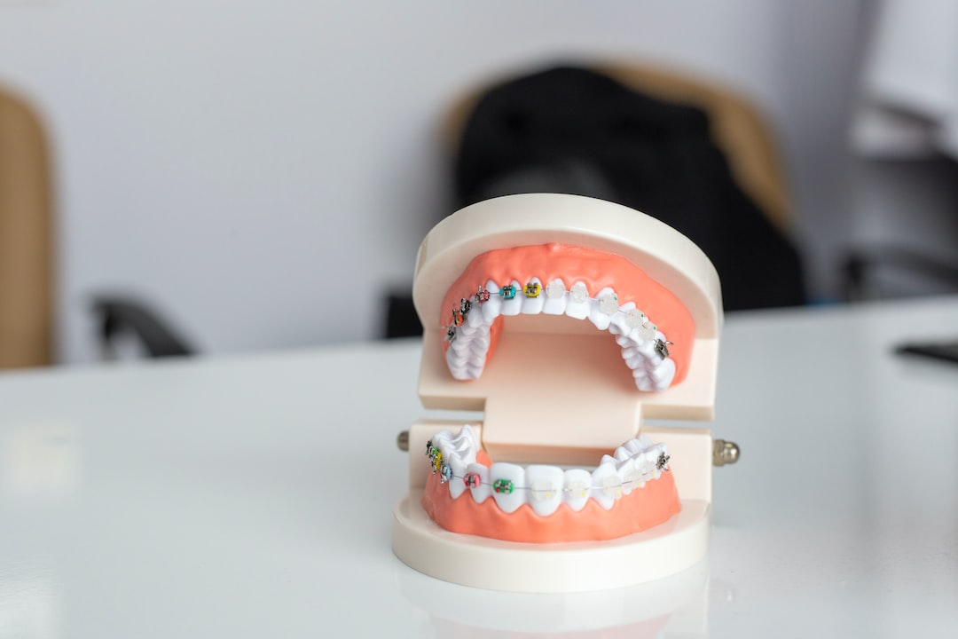 Invisalign vs. Şeffaf Tel Tedavisi: Konuşma ve Yutma Üzerindeki Etkiler Karşılaştırması (Yazının sonuna Sık Sorulan Sorular ekle)