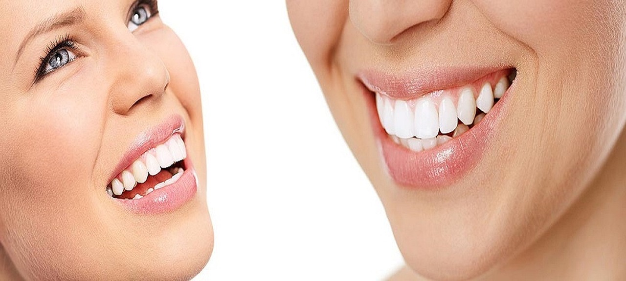 İnvisalign Tedavisinde Kontrol Randevularında Plak Uyumu ve Oturumu Kontrolü