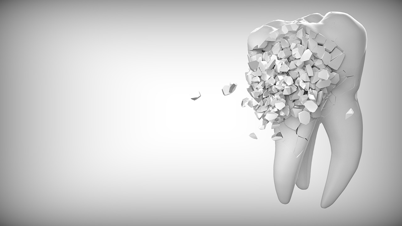 İnvisalign Nedir?