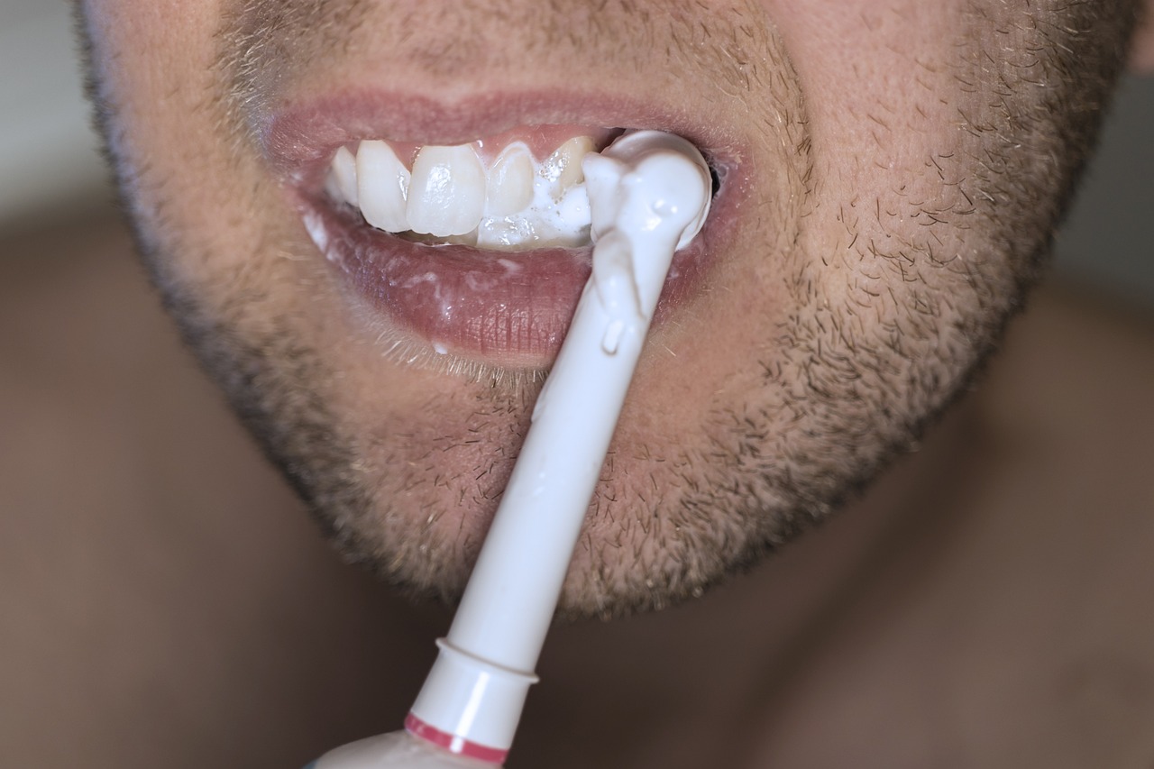 Invisalign Plaklarının Günlük Bakım Rutini: Hijyenik Tutmanın Önemi