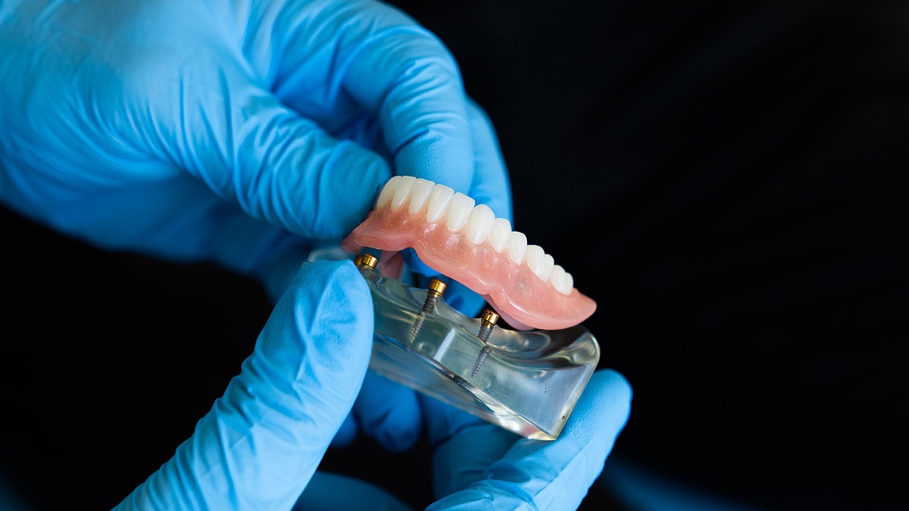 Invisalign Tedavisinin Tamamlanmasının Ardından Gülüşünüzdeki Değişiklikleri Kutlama Yolları