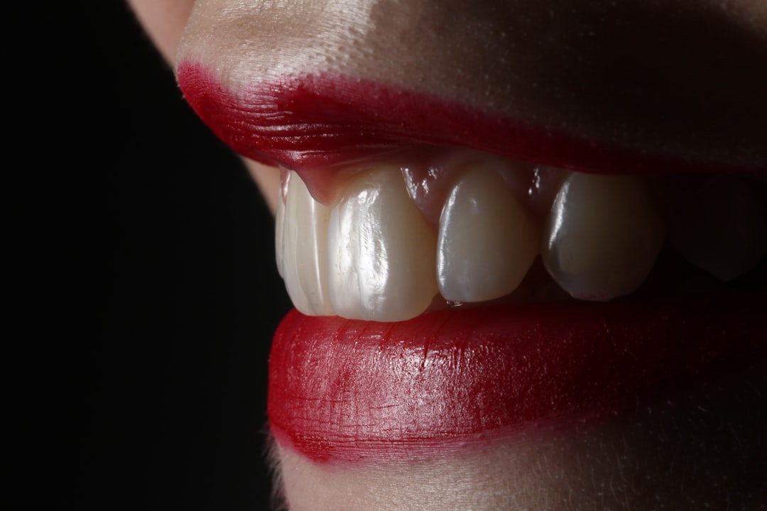 Invisalign Plaklarının Yemekle İlgili Önerileri