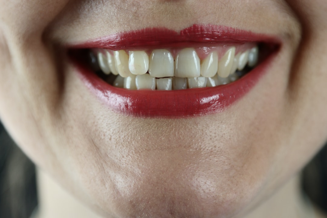 Invisalign vs. Lingual Braketler